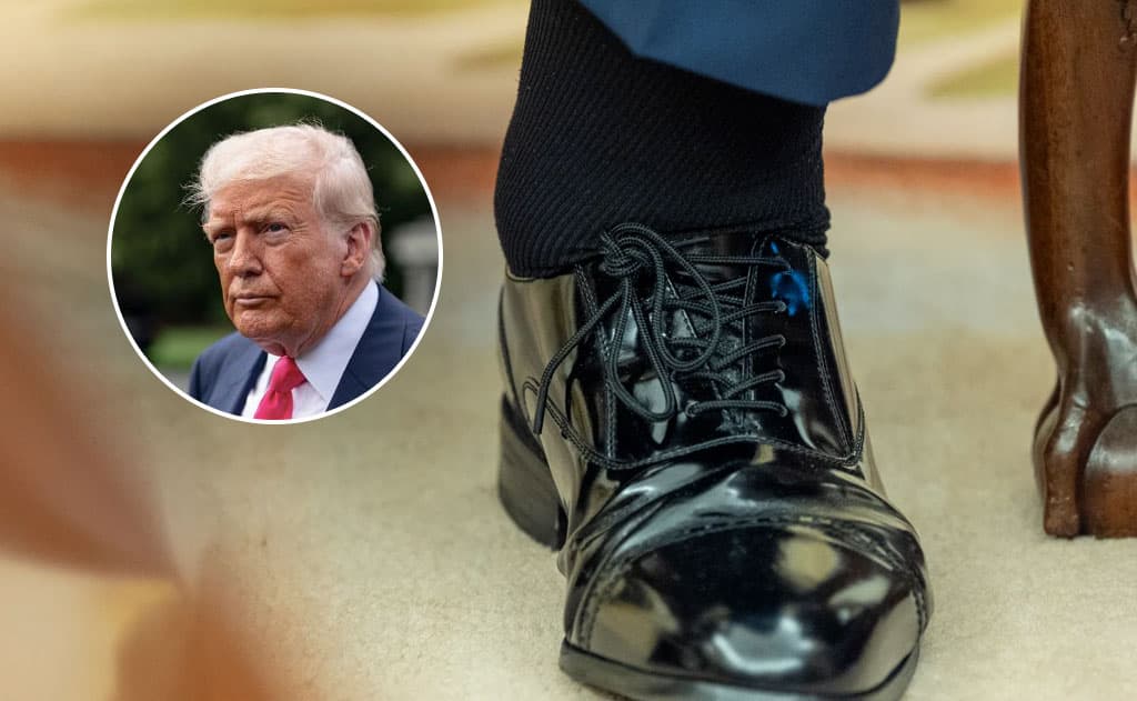 Donald Trump Diagnosed with Chronic Venous